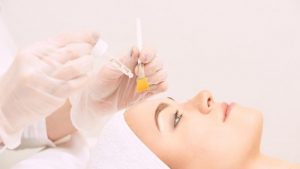 chemical peel in bergen county and fair lawn new jersey