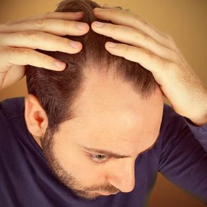 HAIR LOSS & HAIR THINNING​ | Medical Spa | Bergen County