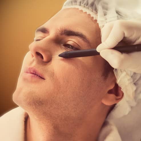 Laser Treatment | Medical Spa | Bergen County