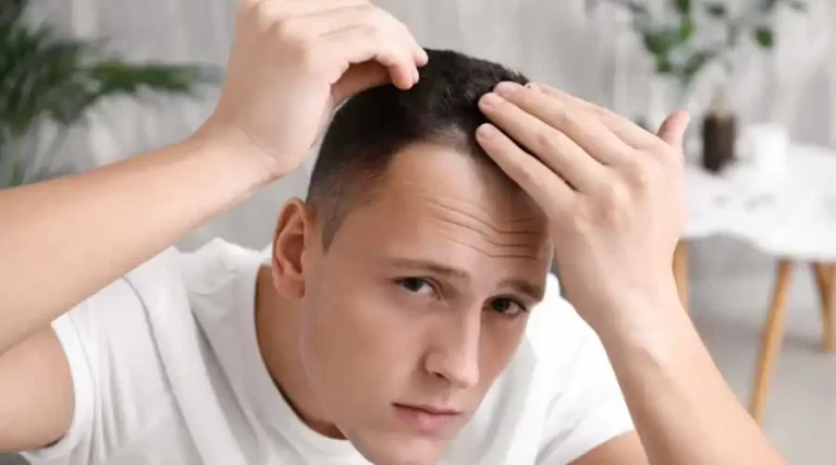 I'm Losing My Hair: Can PRP Injections Help? | Bergen County Hair Loss