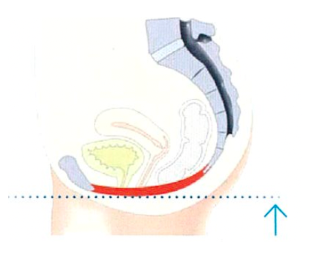 emsella after treatment