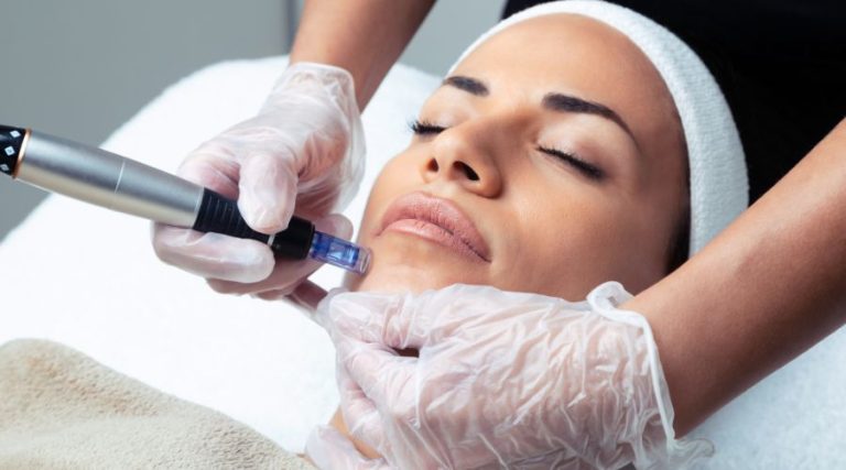 woman getting a microneedling service