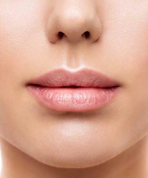 Lips The Botox Lip Flip